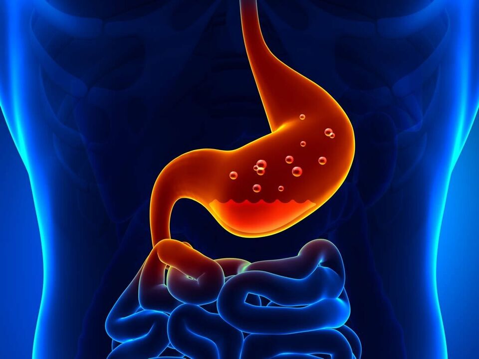 La gastrite est une maladie inflammatoire de l'estomac qui nécessite une alimentation